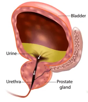 normal-prostate-gland-with-clear-urethra-and-healthy-urine-flow
